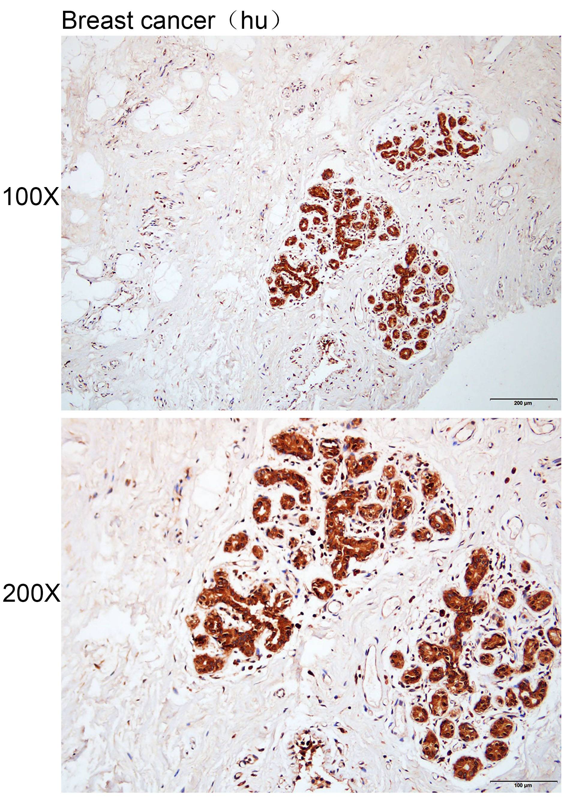 Anti-ACVR1 Polyclonal Antibody