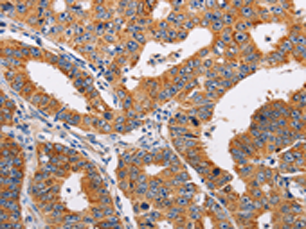 兔抗ADH1A多克隆抗体