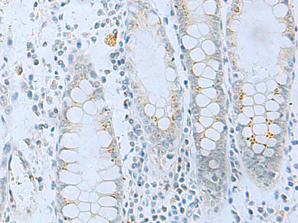 兔抗APOBR多克隆抗体
