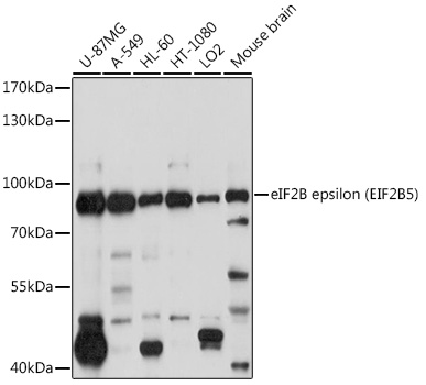 Anti-EIF2B5 Polyclonal Antibod