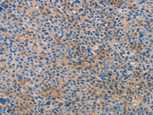 兔抗ALOX15B多克隆抗体