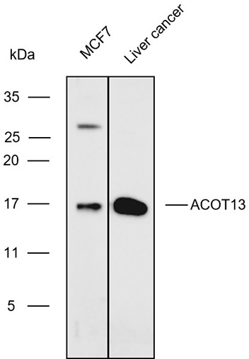 Anti-ACOT13 Polyclonal Antibod