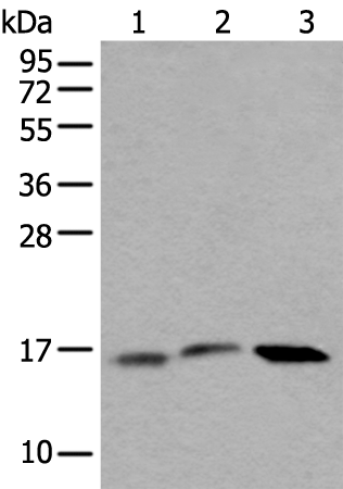 兔抗UBE2G2多克隆抗体