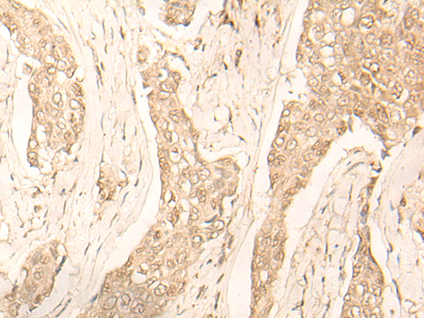 兔抗FAH多克隆抗体