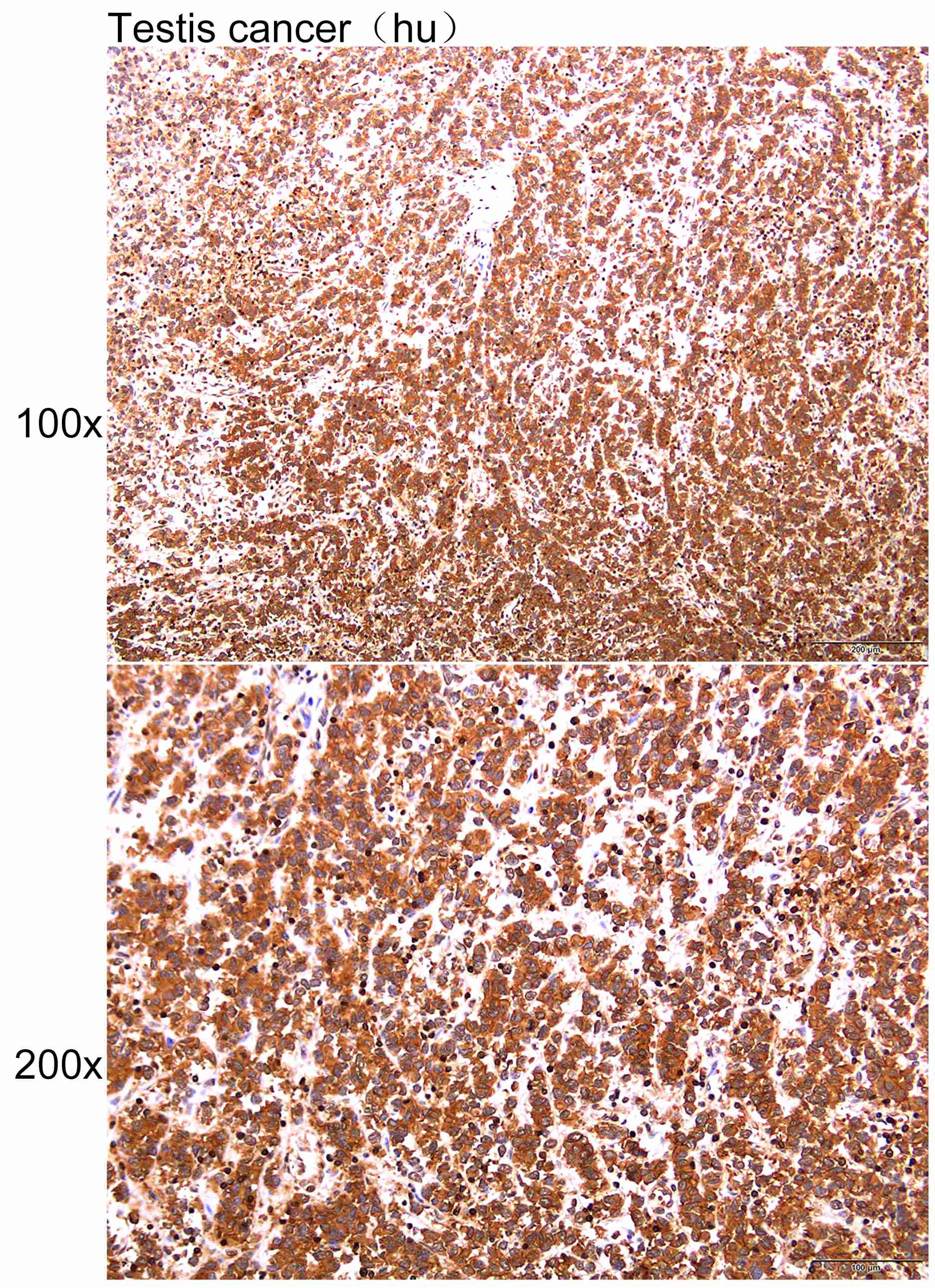 Anti-ACTG1 Polyclonal Antibody