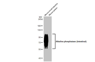 Alkaline phosphatase (intestin