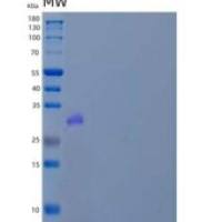 人锚蛋白重复序列和SOCS盒蛋白13/ASB13重组蛋白N-6His