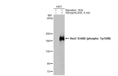 Her2 / ErbB2 (phospho Tyr1248)