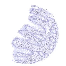 TRPS1 antibody [MSVA-512R] His