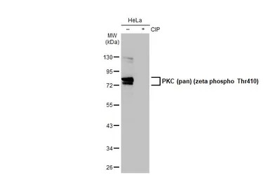 PKC (pan) (zeta phospho Thr410
