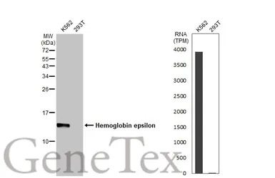 Hemoglobin epsilon antibody [H