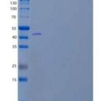人血管紧张素原/丝氨酸蛋白酶抑制剂A8/AGT重组蛋白C-6His