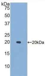 Human IL1F9 protein, His tag