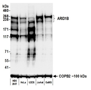 ARID1B Antibody 抗体，orb1806438，