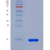 人纽蛋白(VCL)重组蛋白