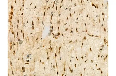 Ki67 (phospho Thr1335) antibod