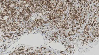 CD1a antibody [MTB1]