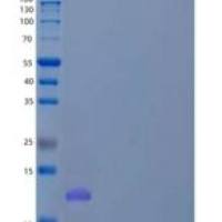 人WW结构域结合蛋白2/WBP2重组蛋白N-6His