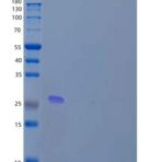 人含锌指MYND结构域的蛋白19/ZMYND19重组蛋白N-6His
