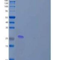 人含锌指MYND结构域的蛋白19/ZMYND19重组蛋白N-6His