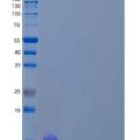人w结构域结合蛋白1/WBP1重组蛋白N-6His