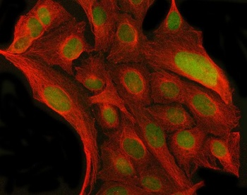 Anti-MYNN Antibody 抗体，orb17860