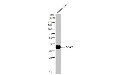 SOX2 antibody [HL1193]