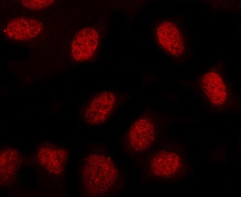 Anti-MINDY3 Antibody 抗体，orb178