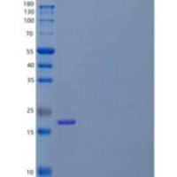 人PRADC1/PAP21重组蛋白C-6His