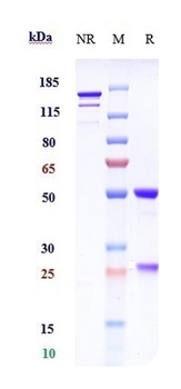 Anti-F11 / Factor XI Reference