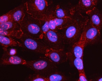 Anti-MYL5 Antibody 抗体，orb17860