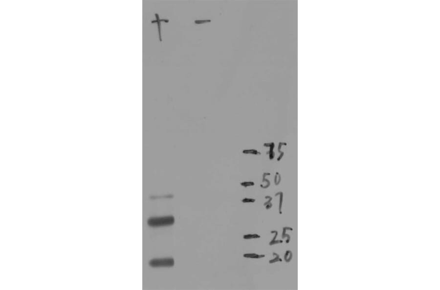 Western Blot - Anti-mCherry Antibody (A85305) - Antibodies.com
