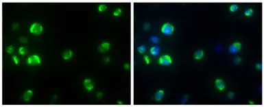 Dengue virus Capsid protein an