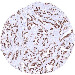 TRPS1 antibody [MSVA-512R] His