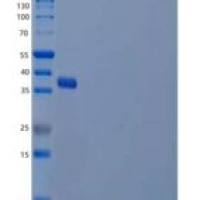 人泛素结合酶E2 J2/UBE2J2重组蛋白N-GST
