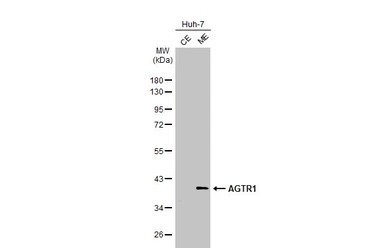 AGTR1 antibody [HL2526]
