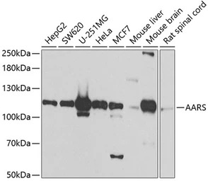 alanyl-tRNA synthetase antibod