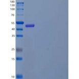人血管生成素样蛋白8/βtrophin(ANGPTL8)重组蛋白N-Fc
