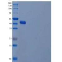 人4型乙醇脱氢酶Mu/ADH7重组蛋白C-6His