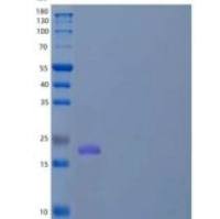 小鼠硬骨素(SOST)重组蛋白C-6His