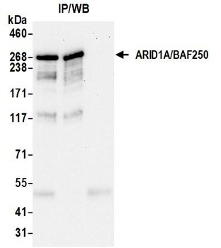 ARID1A/BAF250 Antibody 抗体，orb1