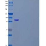 小鼠血小板生成素/THPO/TPO重组蛋白N-6His