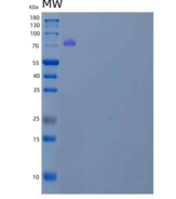 人中间α-球蛋白抑制因子H3(ITIH3)重组蛋白C-6Hi