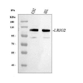 Anti-LRIG2 Antibody 抗体，orb1804
