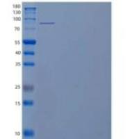人血管紧张素转化酶2(ACE2)重组蛋白C-6His