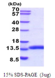 Mouse MIF protein, His tag