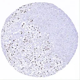 INSM1 antibody [MSVA-456R] His