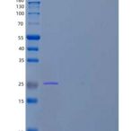 人激肽释放酶4(KLK4)重组蛋白C-6His