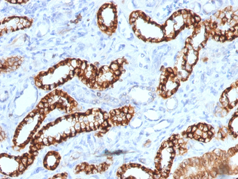 CDH16 antibody [rCDH16/1071]