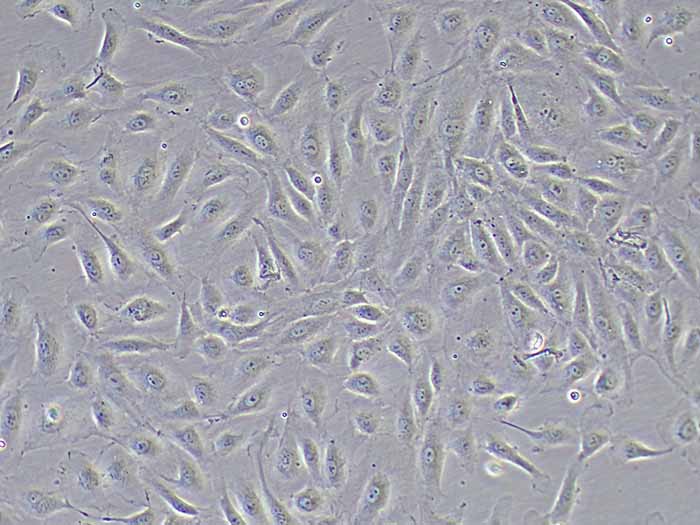 人脐静脉内皮细胞HUVEC图片